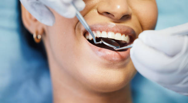 Best Emergency Denture Repair in North East, MD